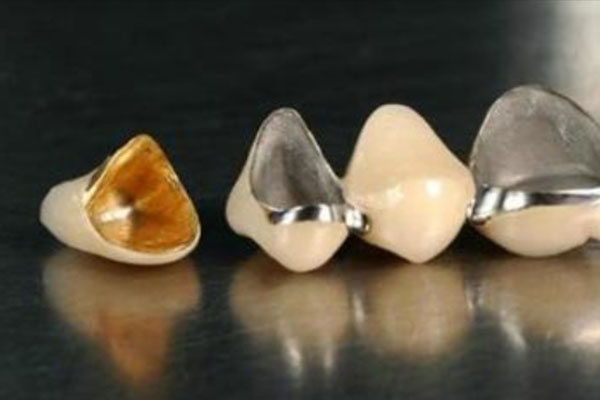 贴瓷牙的省钱攻略：中老年口腔批量