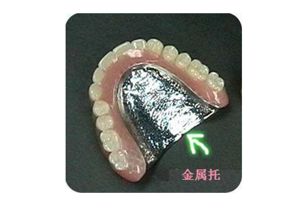 活动义齿护理总出错？中老年口腔批量处理方案让效率翻倍！