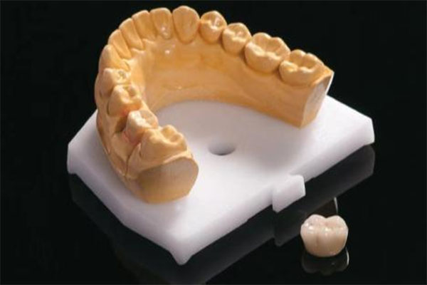 活动义齿修复几次？中老年口腔批量修复方案一次解决缺牙烦恼