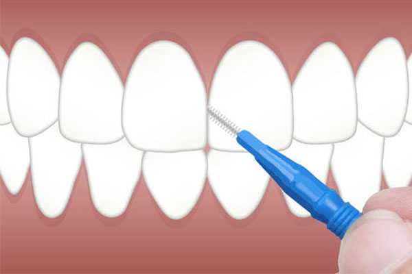 洗牙 vs 冷光美白：中老年口腔专家建
