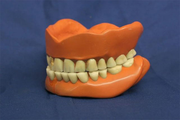 重庆口腔义齿加工厂招聘揭秘！中老年口腔批量定制效率翻倍的