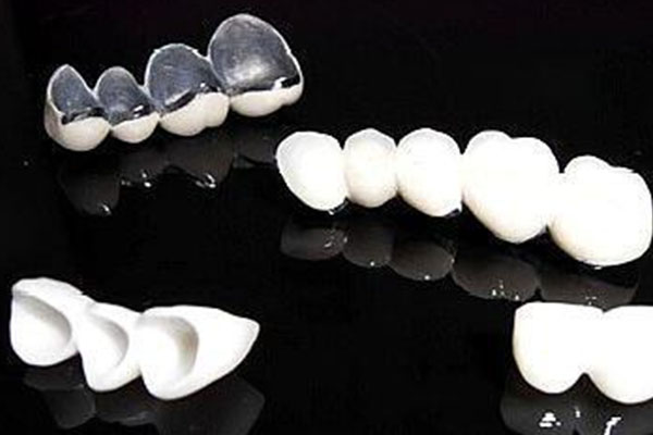 全瓷牙冠 vs 烤瓷牙冠：哪个更适合拆除？中老年口腔专家解析舒