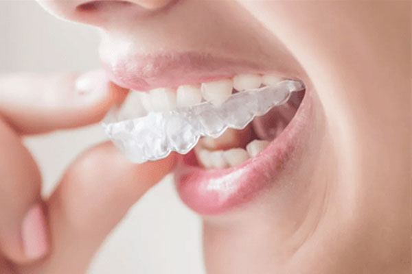 正畸拍照标准：中老年口腔牙齿缺失