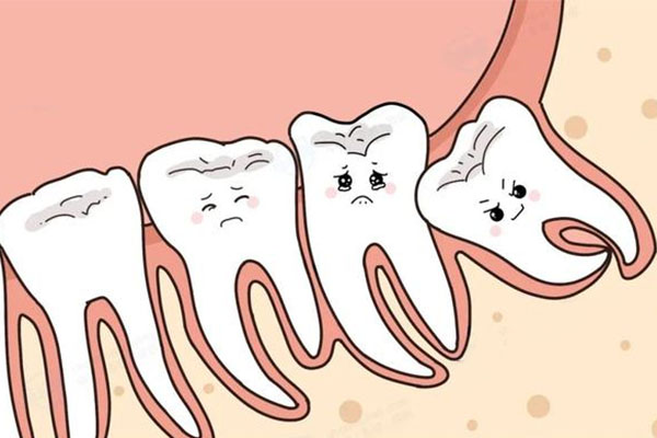拔智齿多少钱一颗？中老年口腔为您