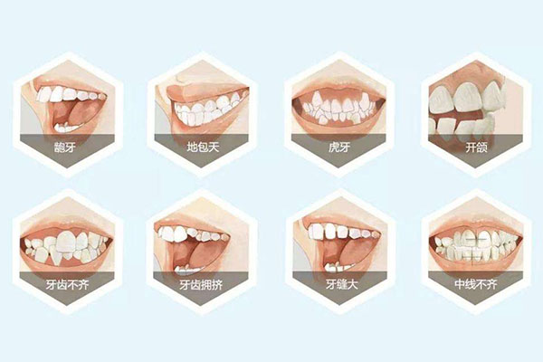 松动的牙齿怎么修复？中老年口腔批量修复方案，省心又高效