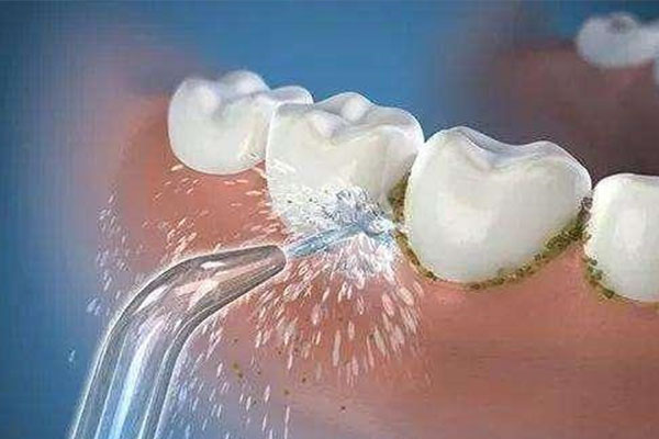 洗牙真的能美白？中老年口腔专家告