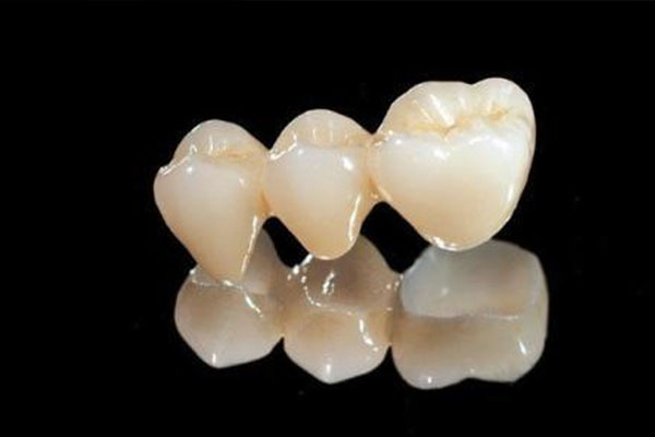 门牙6颗全瓷牙连冠多少钱？中老年口