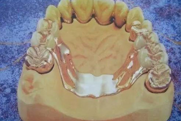 半口活动假牙多少钱一副？中老年口