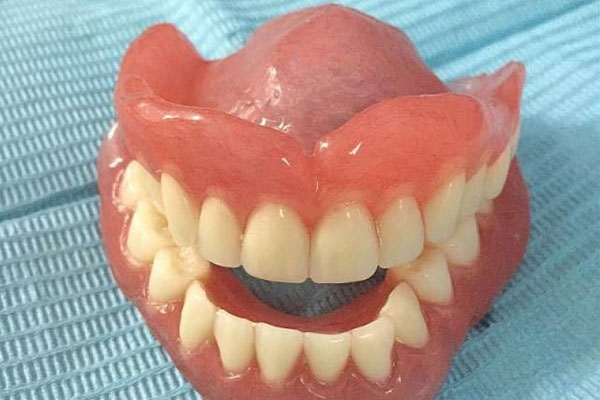 活动假牙种类及价格 | 中老年口腔的