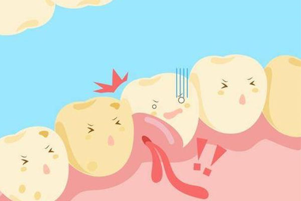 四黄牙齿(黄牙和四环素牙的区别)