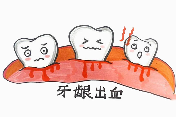 刷牙每天出血是怎么回事