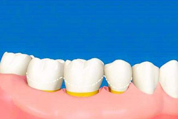 天生的牙黄可以改变吗为什么(天生的牙黄可以改变吗为什么还会变黑)