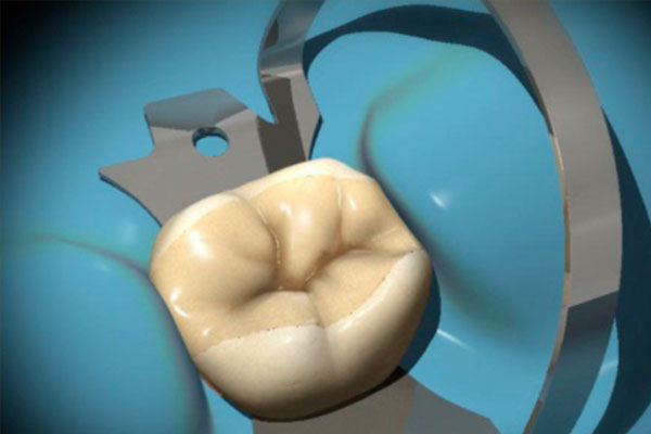 小孩牙根尖炎怎么治疗效果好呢(小孩