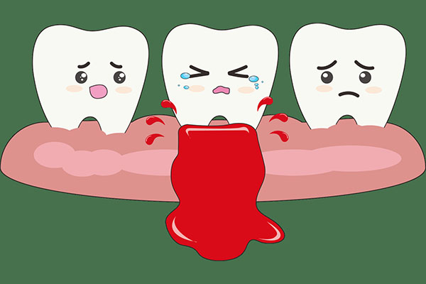 刷牙牙龈出血怎么回事