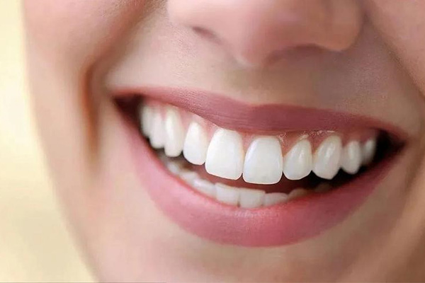 牙齿色素沉着如何去掉(牙齿色素沉着如何去掉小妙招)