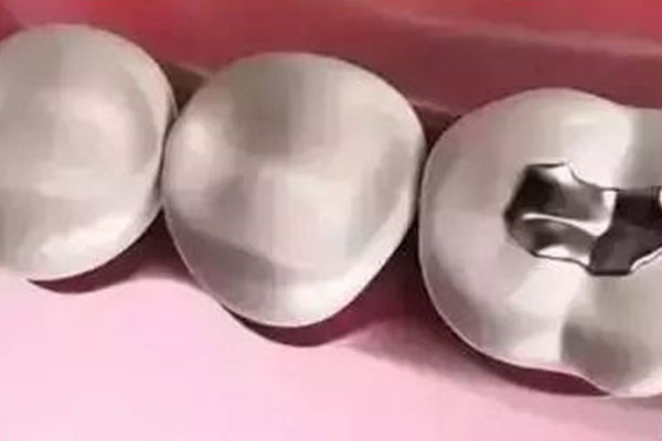 儿童补牙在哪里好(儿童补牙在哪里好