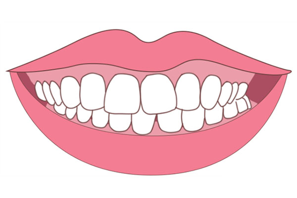 龅牙女子夸张表演(呲牙女孩是谁)