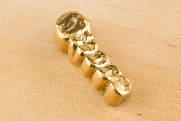 地包天必须要手术吗(地包天必须手术治疗吗)