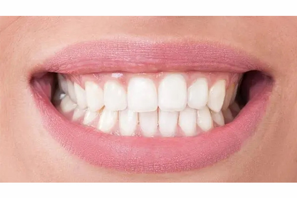 小孩子牙齿上有黑点(小孩子牙齿上有黑点怎么回事)