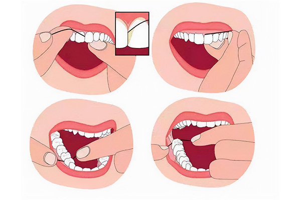 医院有洗牙的项目吗