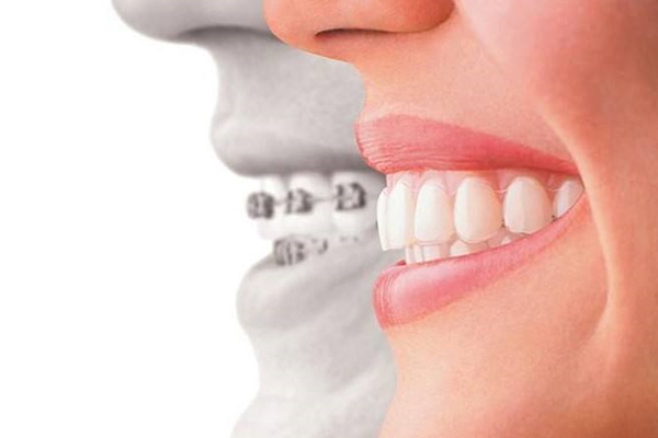 龅牙姐照片(龅牙姐叫什么名字)