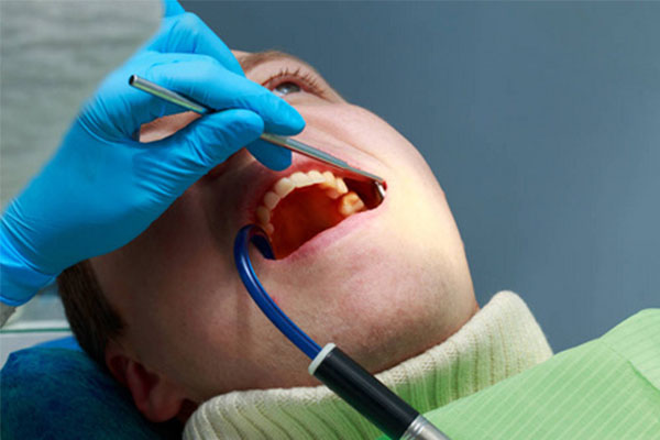 小孩牙齿根尖炎怎么治疗最好的方法