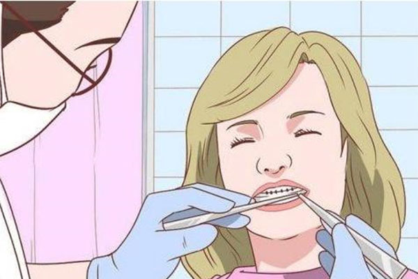 牙齿脱敏剂怎么使用(牙齿脱敏剂怎么