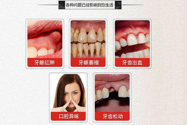 孕妇根尖周炎怎么治疗最好(孕妇根尖