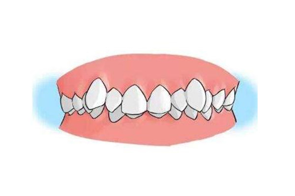 龅牙妹电视剧怀旧台湾(tvb龅牙妹)