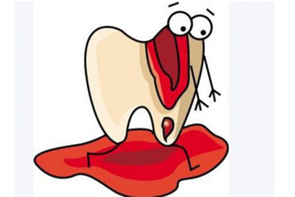 刷牙牙龈老出血是什么原因