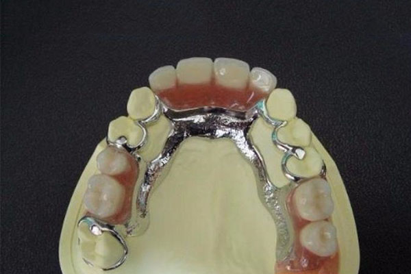 中老年口腔揭秘：固定义齿省钱攻略！缺牙患者必看的低价位解