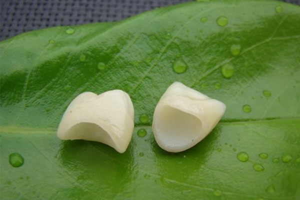 牙齿瓷面贴片怎么贴？中老年口腔教您快速解决牙齿缺失烦恼