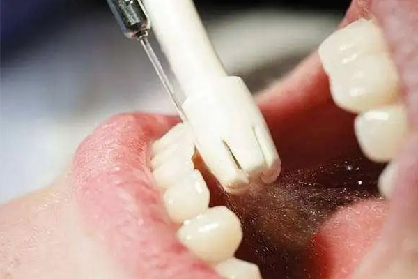 老年人洗牙会掉牙吗？中老年口腔专家告诉你真相！