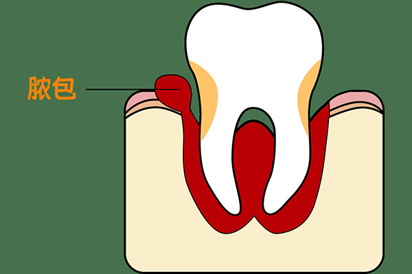 吃不下饭睡不好？坏牙根疼到崩溃？