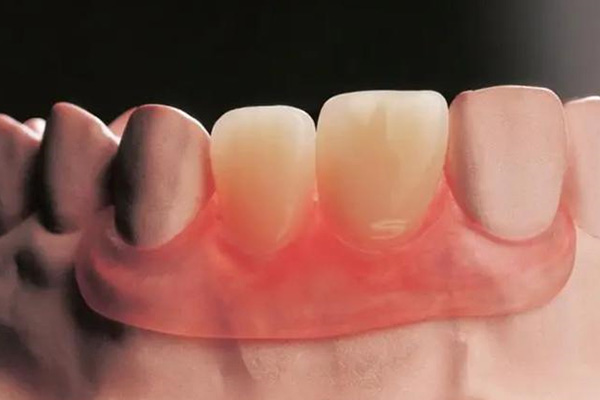 中老年口腔提醒：活动义齿这3大危害