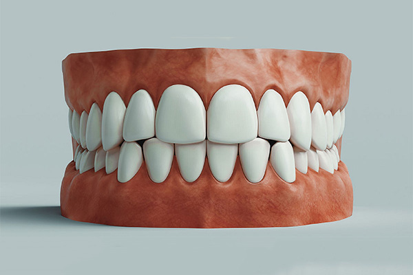 活动假牙哪种最舒服？中老年口腔为