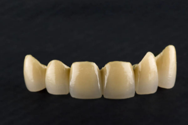 门牙牙冠多少钱？中老年口腔批量修复效率高费用透明