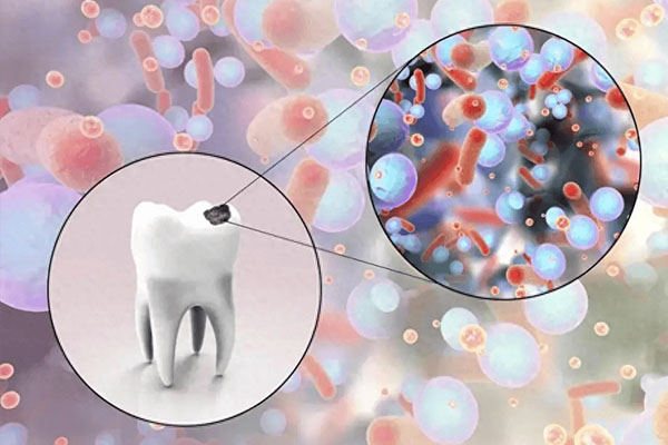 中老年口腔：揭秘龋牙保险公司不报