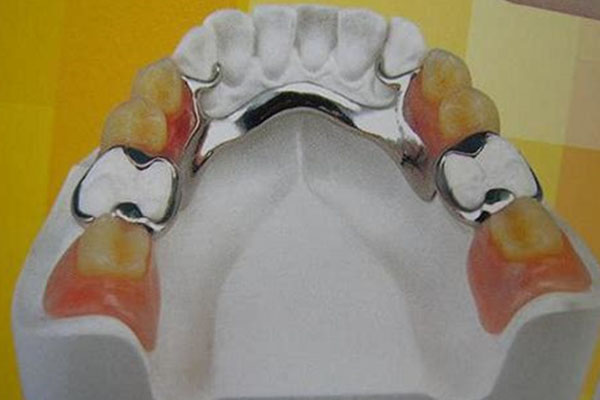 活动性义齿浸泡护理新选择 中老年口腔推出高效批量清洁方案