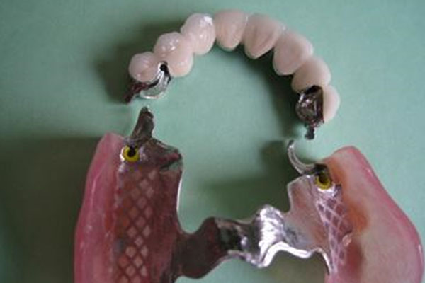 义齿和牙套有什么区别？中老年口腔专家为您解答