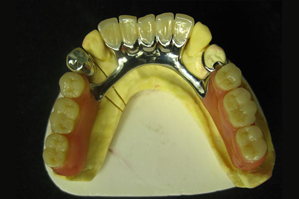 北京洋紫荆义齿加工厂扩招技术团队