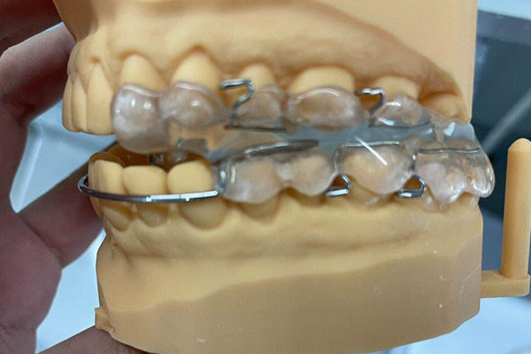 做活动假牙多少钱一颗？中老年口腔