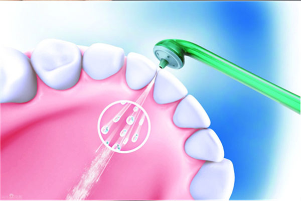 补过牙后能洗牙吗？中老年口腔专家为您解答！