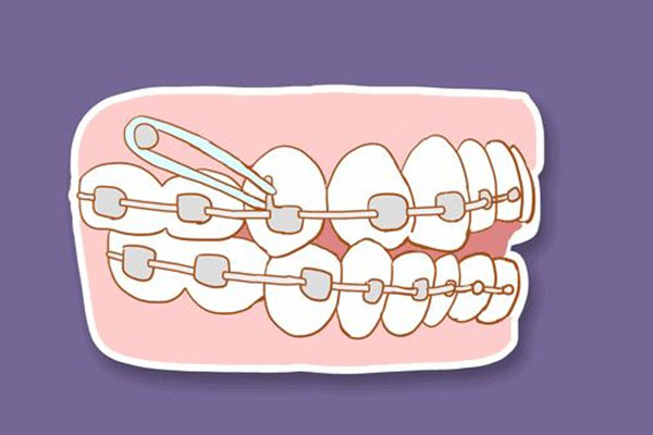 38岁牙齿松动别慌！中老年口腔教你高