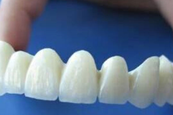 800元一颗的全瓷牙真的靠谱吗？使用时间能有多久？