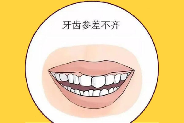 15岁门牙松动别慌张，中老年口腔教你