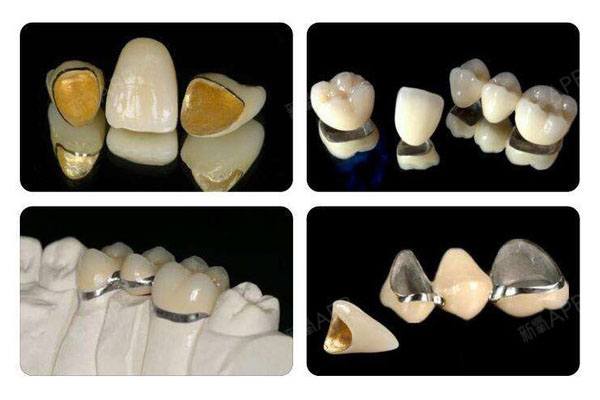 自凝树脂调拌太麻烦？中老年口腔批