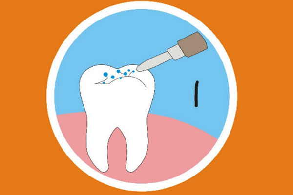 儿童涂氟后多久不能吃东西？半小时