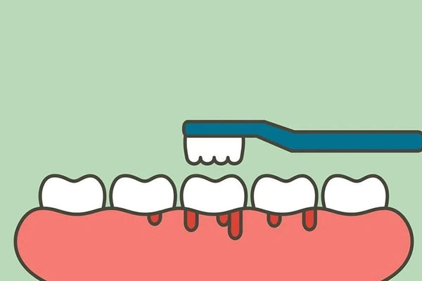 洗牙真的能让牙齿变白？90%的中老年人都弄错了！中老年口腔批
