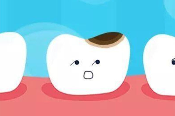 智齿蛀牙怎么办？中老年口腔批量修